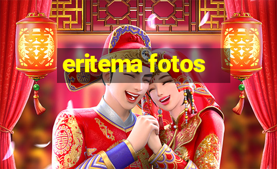 eritema fotos