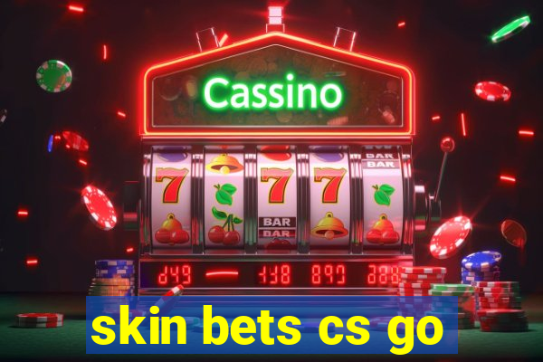 skin bets cs go