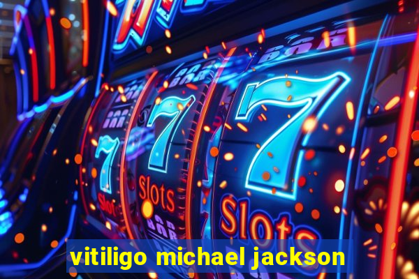 vitiligo michael jackson