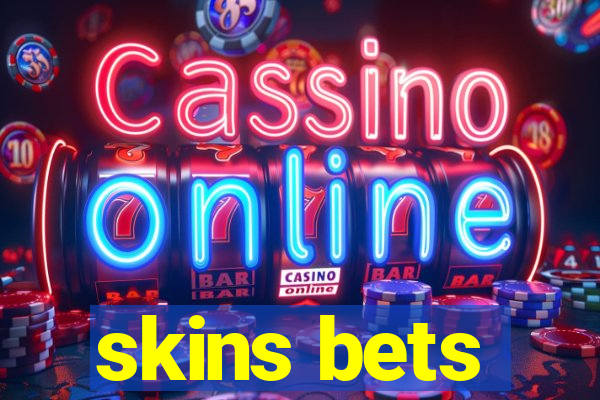 skins bets