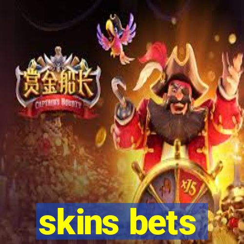 skins bets